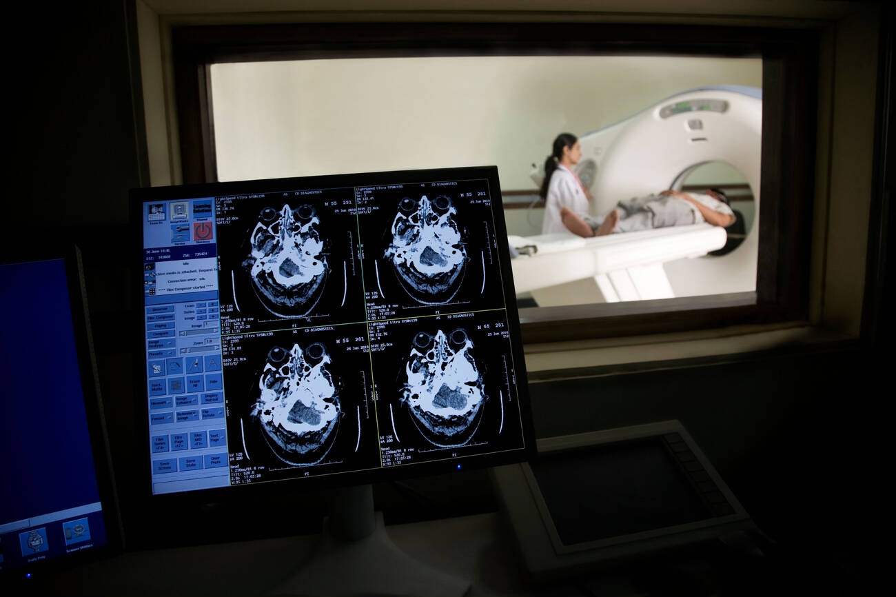 CT scan não hiển thị các vùng bệnh lý AI phát hiện